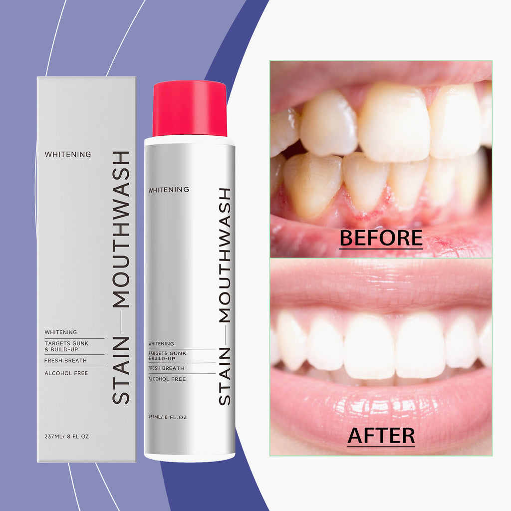 Stain-Removing Whitening Mouthwash 237ml