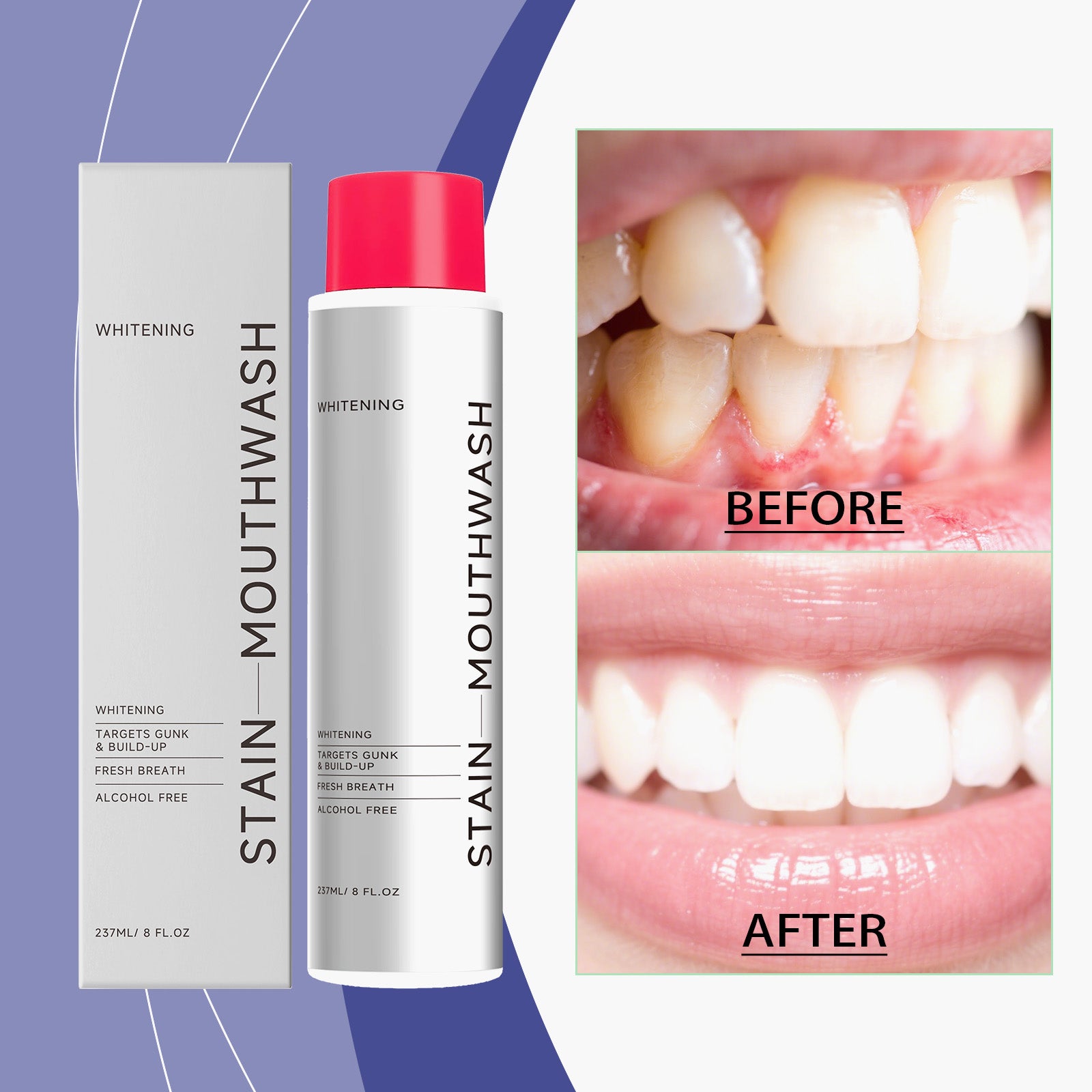 Stain-Removing Whitening Mouthwash 237ml