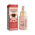 Daily Scalp Cleansing Serum For Flake-free Oil-control Care