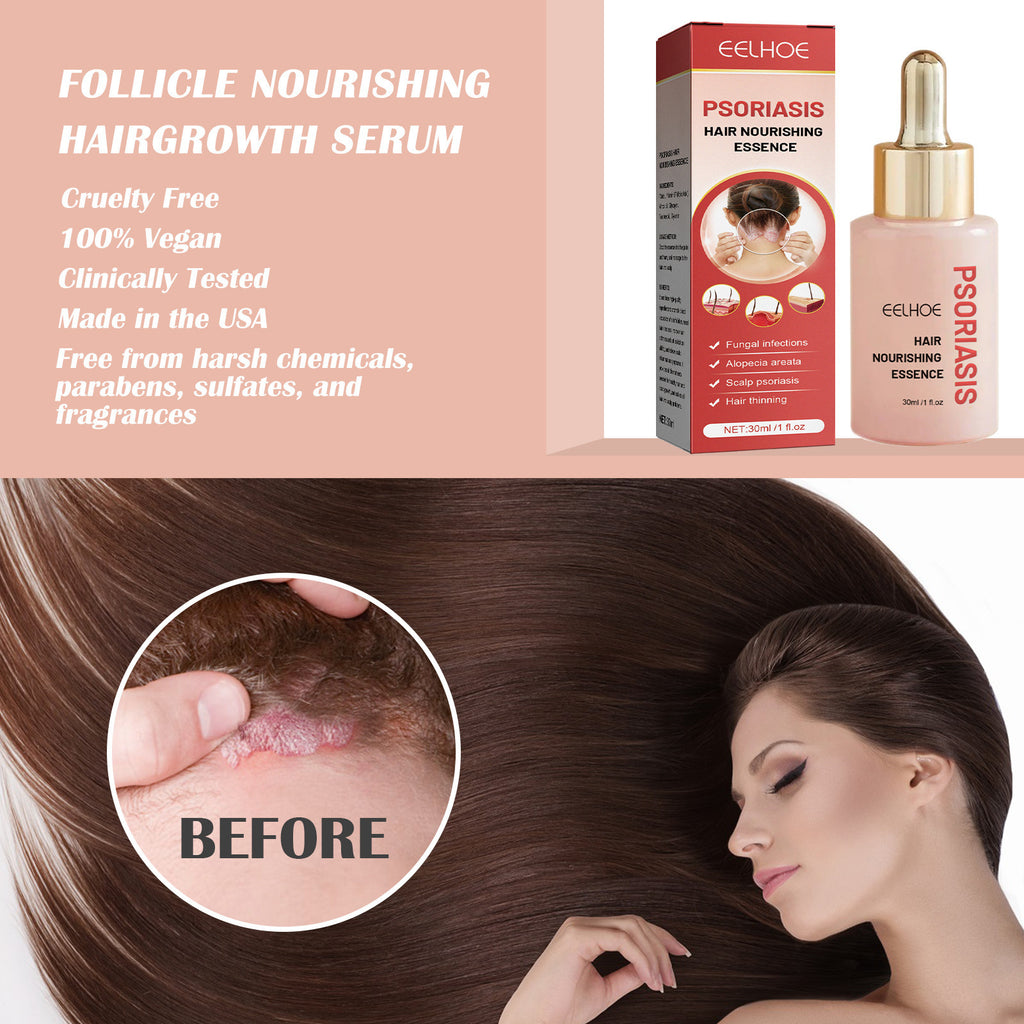 Daily Scalp Cleansing Serum For Flake-free Oil-control Care